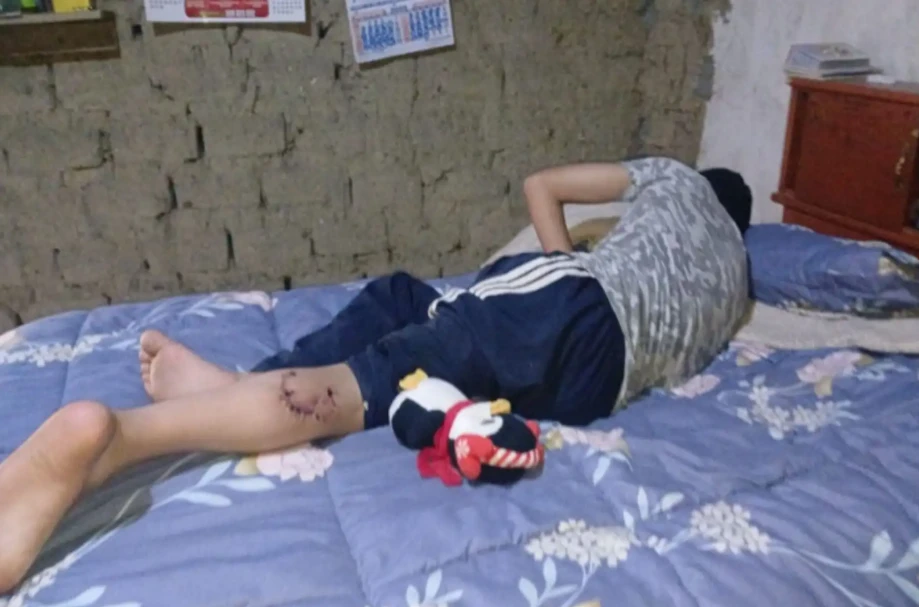 Ataque de perro a niño en Chilca reabre debate sobre control de canes